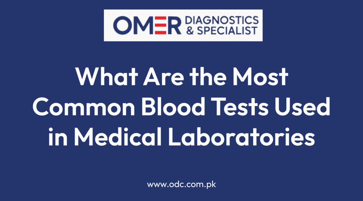What Are the Most Common Blood Tests Used in Medical Laboratories