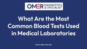 What Are the Most Common Blood Tests Used in Medical Laboratories