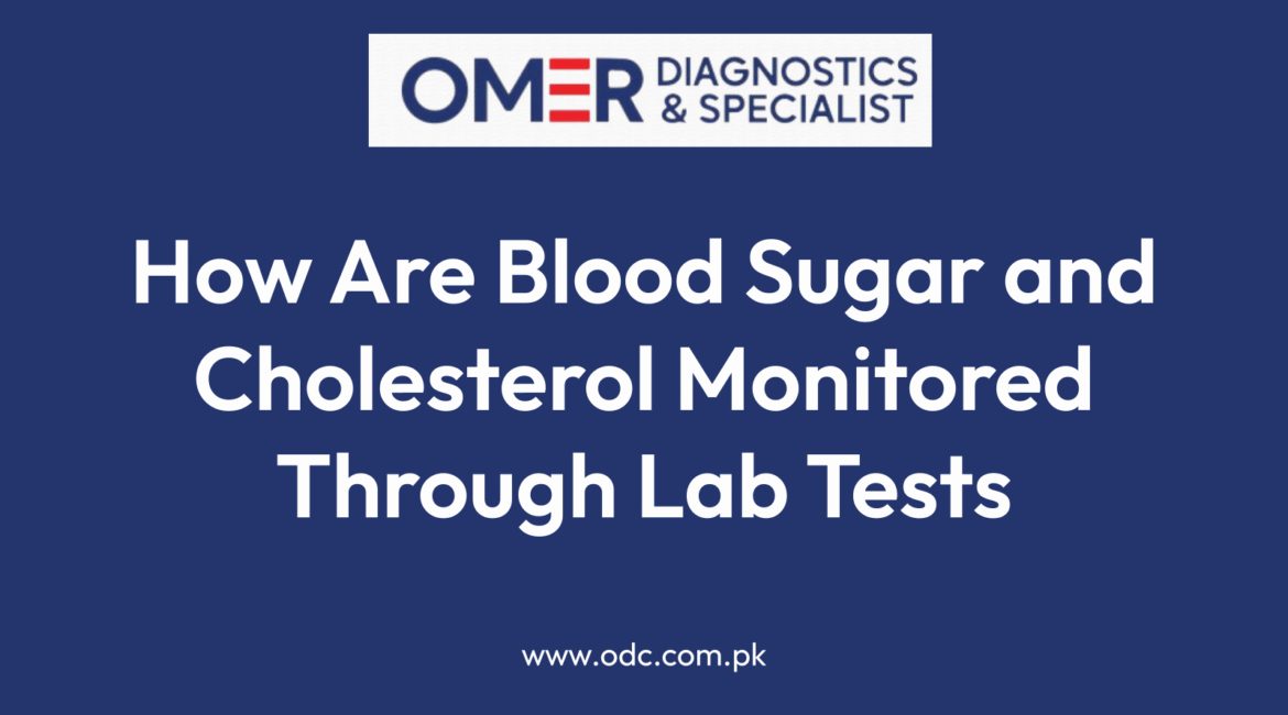 How Are Blood Sugar and Cholesterol Monitored Through Lab Tests