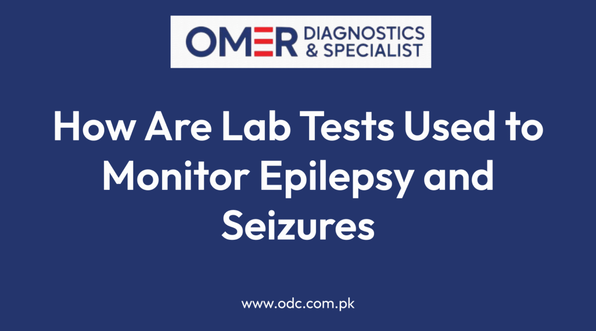 How Are Lab Tests Used to Monitor Epilepsy and Seizures
