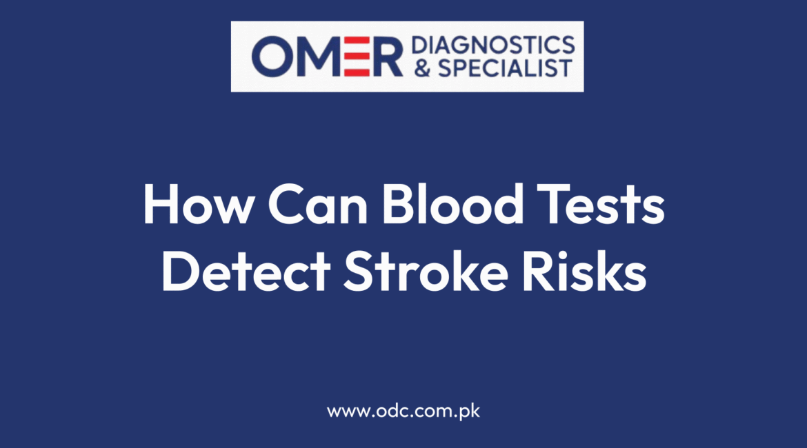 How Can Blood Tests Detect Stroke Risks