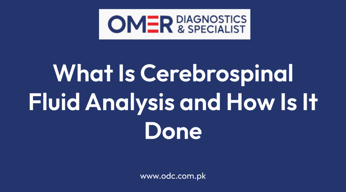 What Is Cerebrospinal Fluid Analysis and How Is It Done