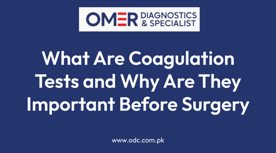 What Are Coagulation Tests and Why Are They Important Before Surgery