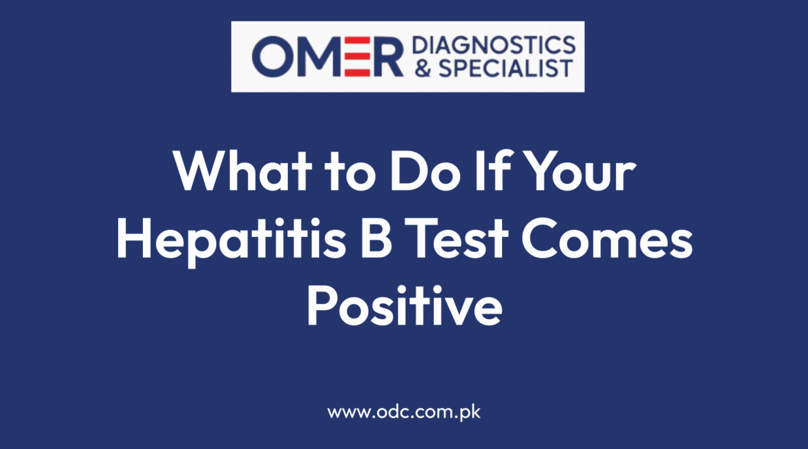 What to Do If Your Hepatitis B Test Comes Positive