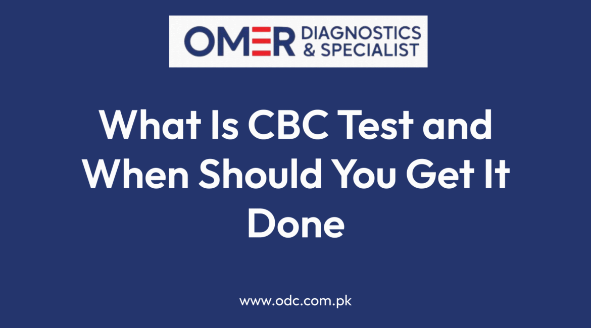 What Is CBC Test and When Should You Get It Done