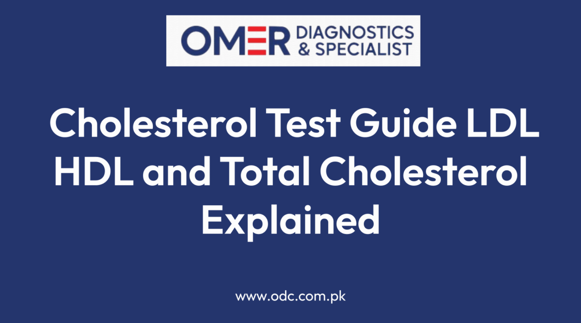 Cholesterol Test Guide LDL HDL and Total Cholesterol Explained