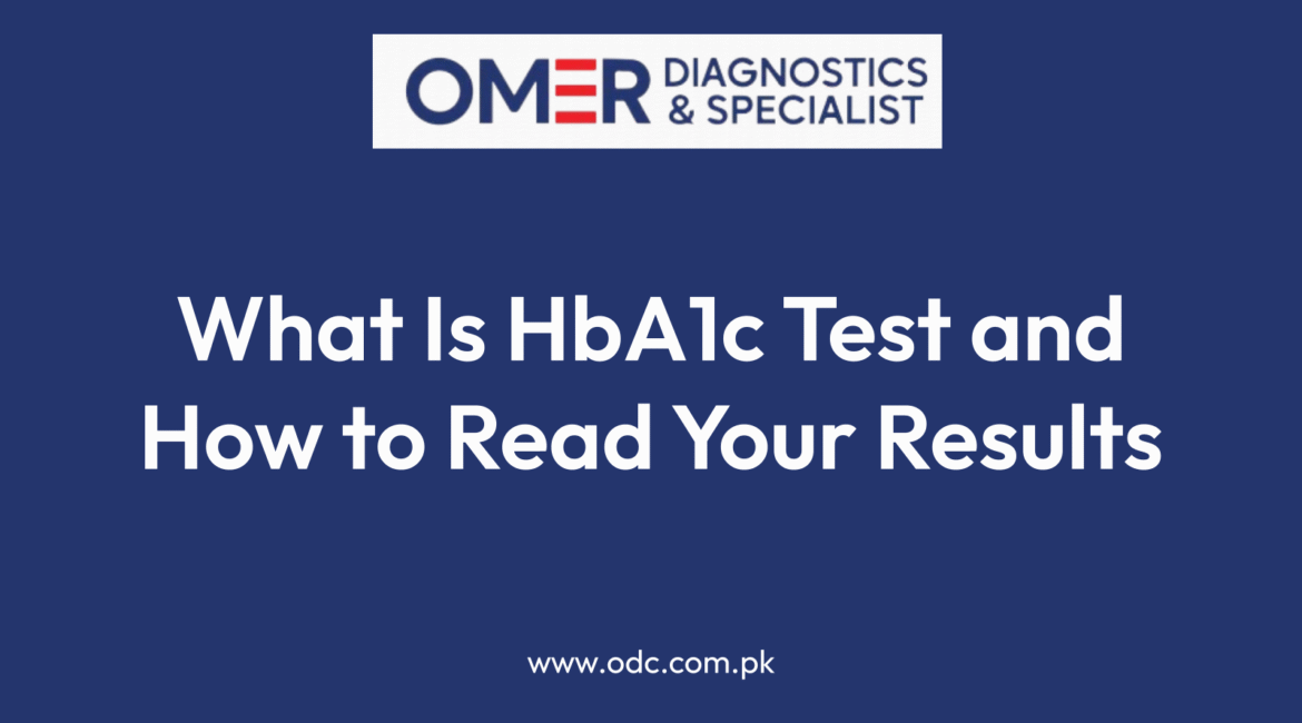 What Is HbA1c Test and How to Read Your Results