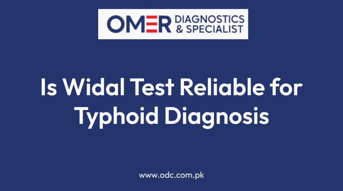 Is Widal Test Reliable for Typhoid Diagnosis