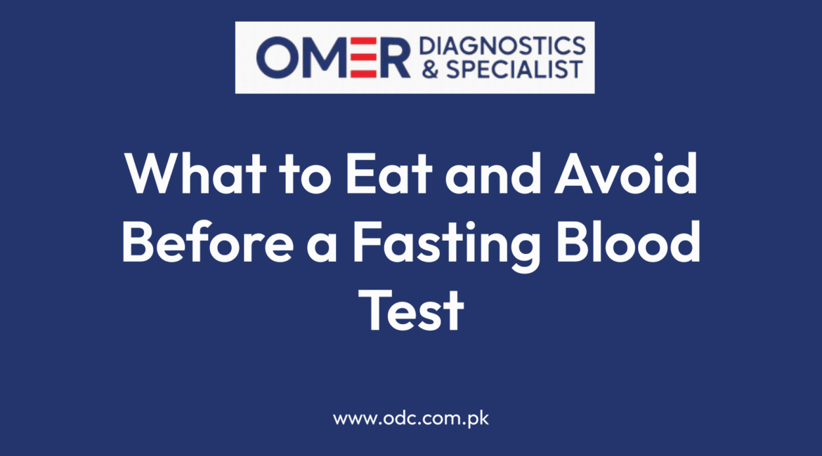 What to Eat and Avoid Before a Fasting Blood Test