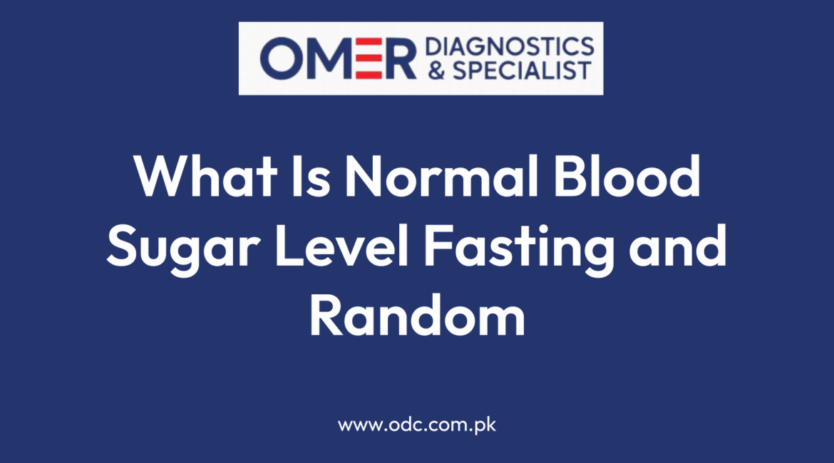 What Is Normal Blood Sugar Level Fasting and Random