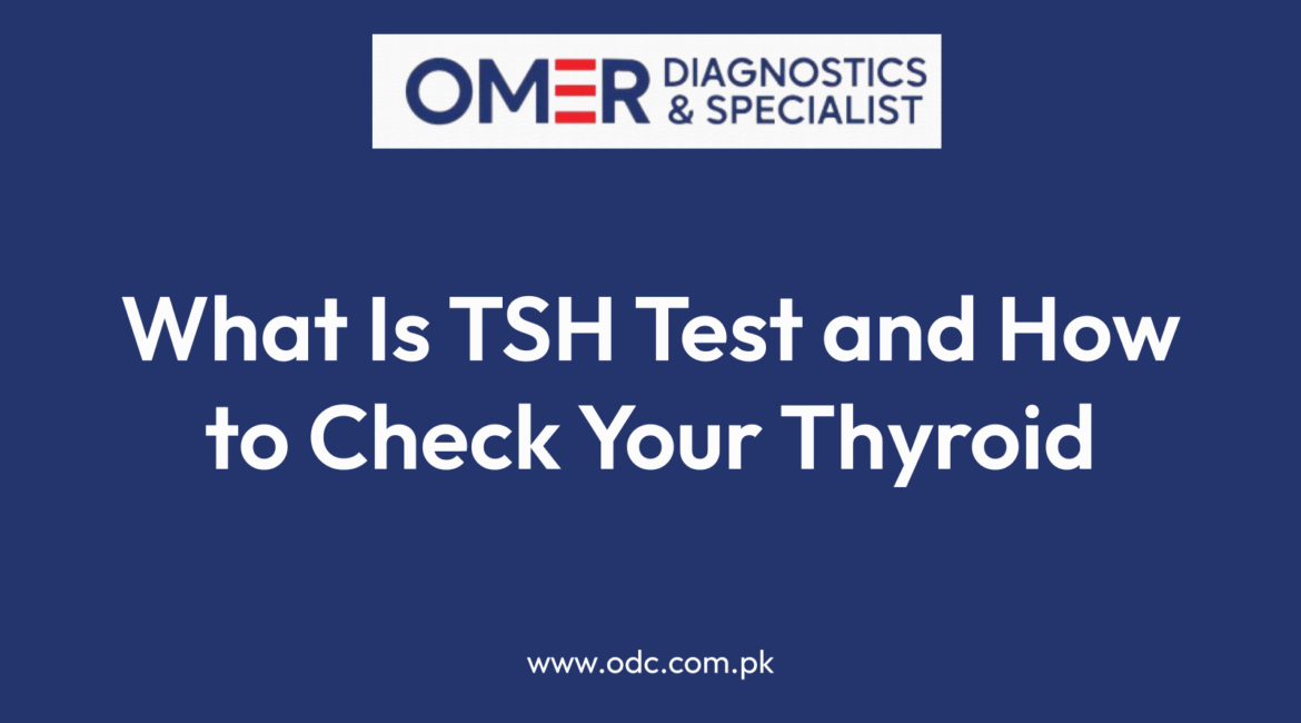 What Is TSH Test and How to Check Your Thyroid