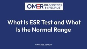 What Is ESR Test and What Is the Normal Range