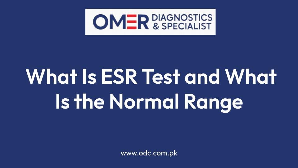 What Is ESR Test and What Is the Normal Range