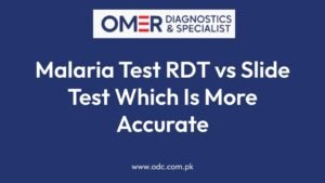 Malaria Test RDT vs Slide Test Which Is More Accurate