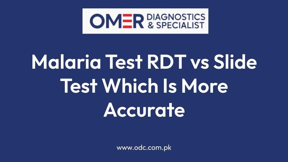 Malaria Test RDT vs Slide Test Which Is More Accurate
