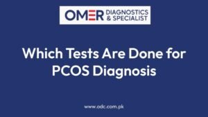Which Tests Are Done for PCOS Diagnosis