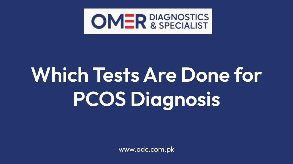 Which Tests Are Done for PCOS Diagnosis