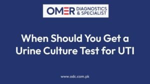 When Should You Get a Urine Culture Test for UTI