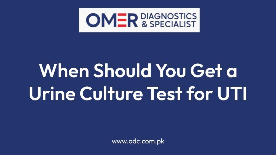 When Should You Get a Urine Culture Test for UTI