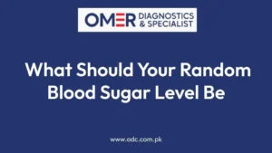 What Should Your Random Blood Sugar Level Be