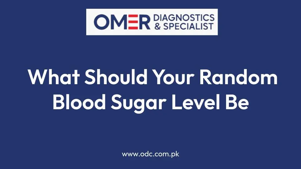 What Should Your Random Blood Sugar Level Be