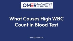 What Causes High WBC Count in Blood Test