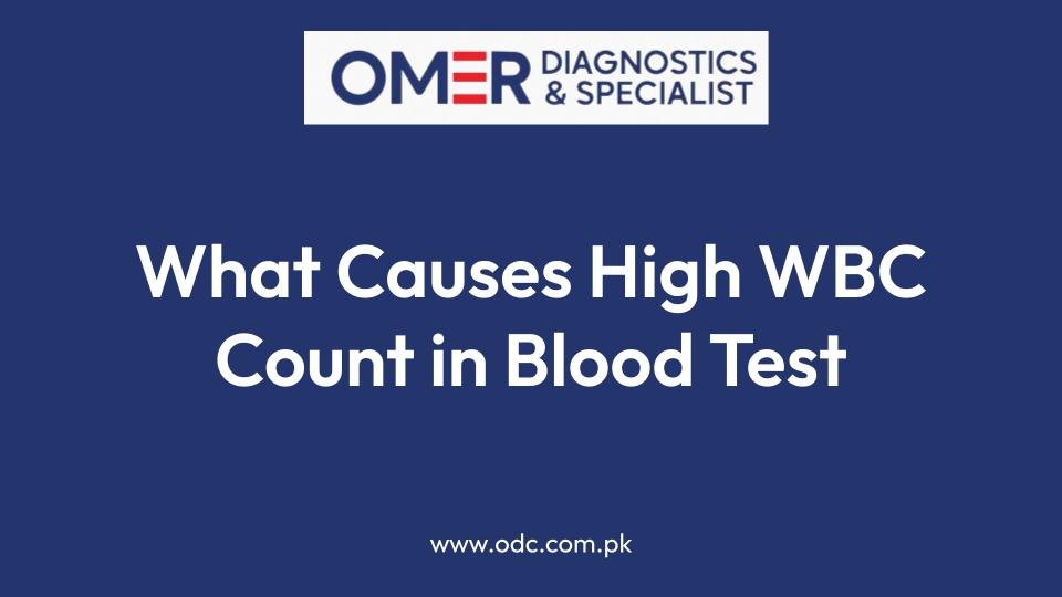 What Causes High WBC Count in Blood Test