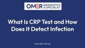 What Is CRP Test and How Does It Detect Infection