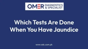 Which Tests Are Done When You Have Jaundice