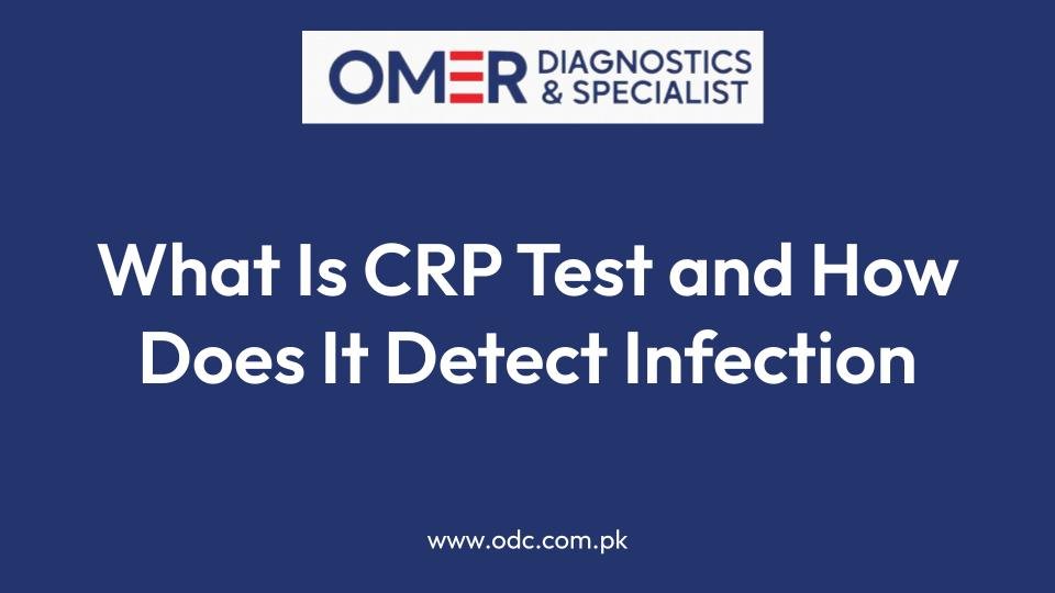 What Is CRP Test and How Does It Detect Infection