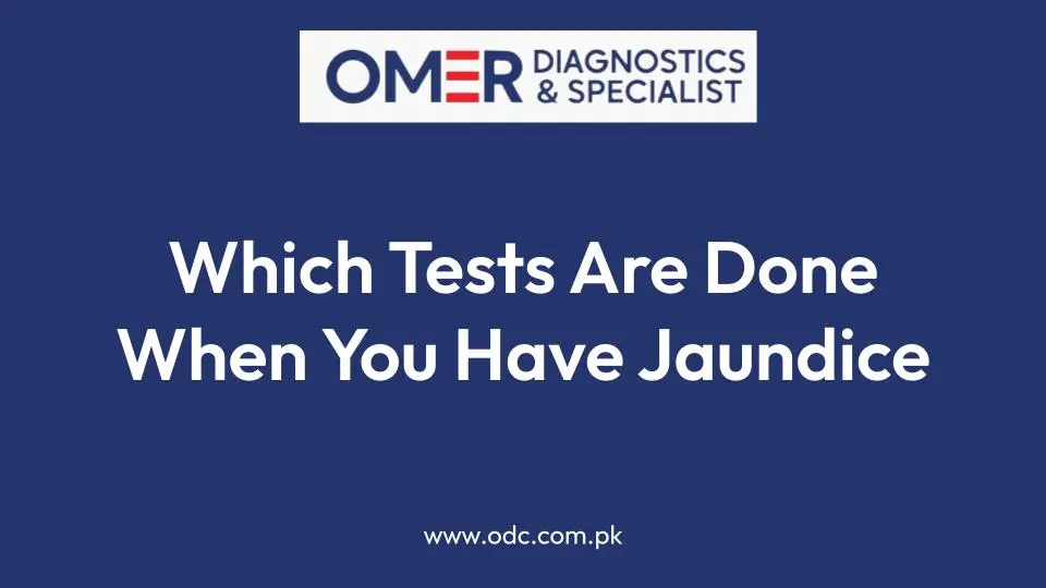 Which Tests Are Done When You Have Jaundice