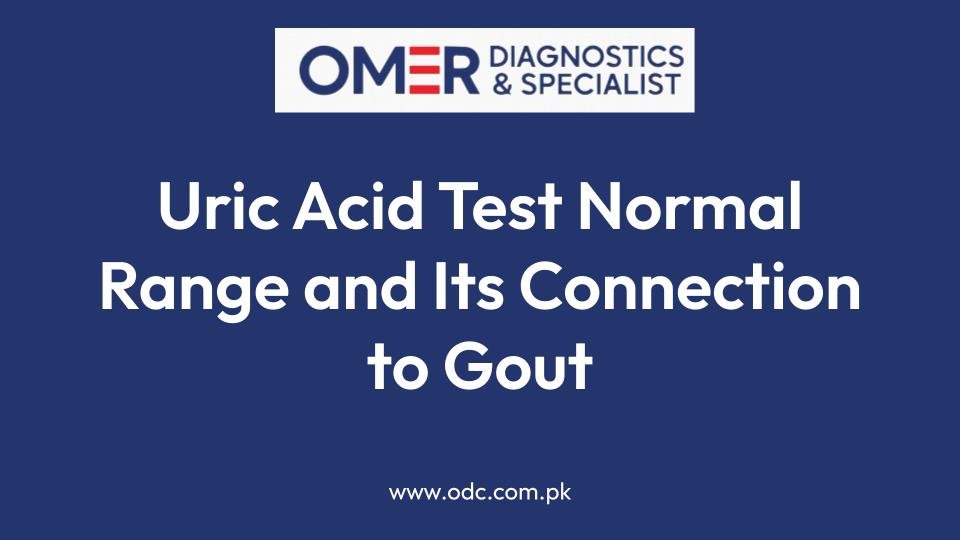 Uric Acid Test Normal Range and Its Connection to Gout