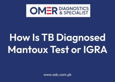 How Is TB Diagnosed Mantoux Test or IGRA