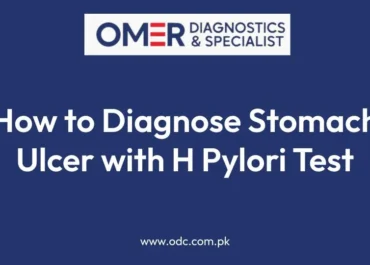 How to Diagnose Stomach Ulcer with H Pylori Test