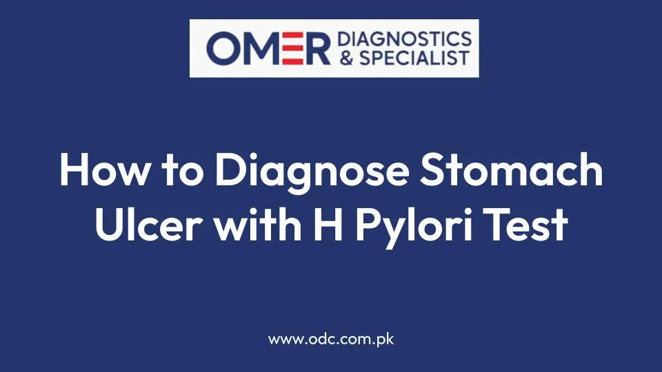 How to Diagnose Stomach Ulcer with H Pylori Test