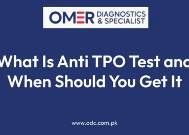 What Is Anti TPO Test and When Should You Get It