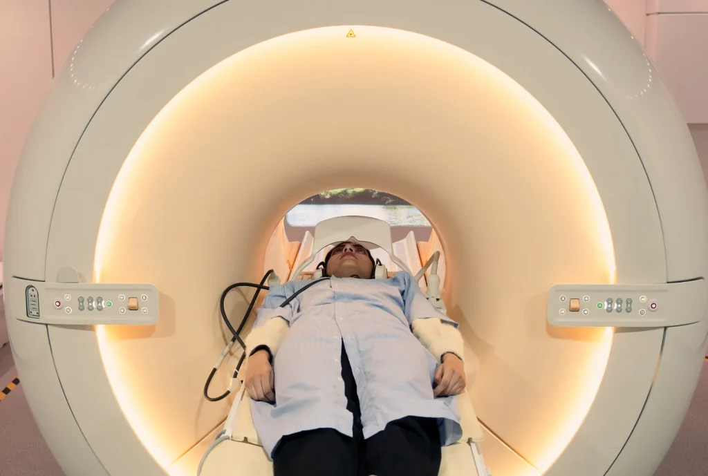 CT Angiography